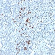 Formalin-fixed, paraffin embedded human tonsil sections stained with 100 ul anti-Kappa Light Chain (clone TB28-2) at 1:200. HIER epitope retrieval prior to staining was performed in 10mM Citrate, pH 6.0.